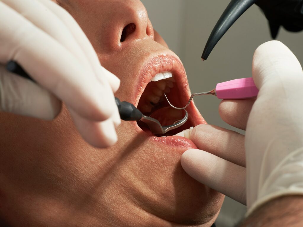 Caroline lm jibssizvpza unsplash Live Sv when cosmetic dentistry becomes restorative dentistry in disguise