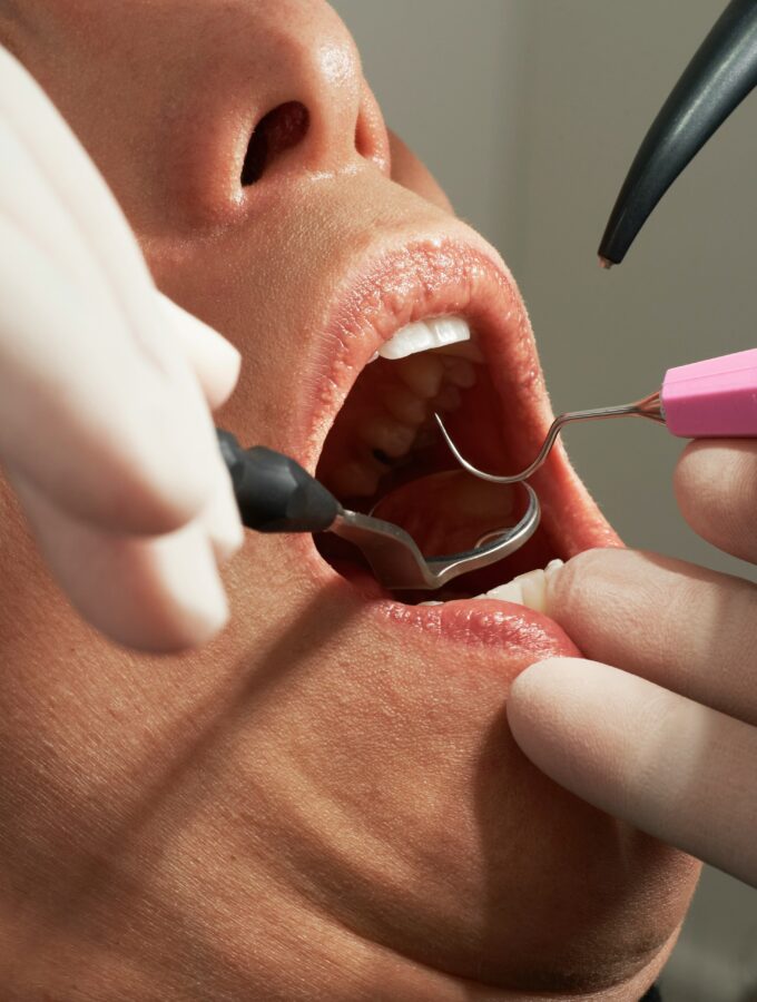 Caroline lm jibssizvpza unsplash Live Sv when cosmetic dentistry becomes restorative dentistry in disguise