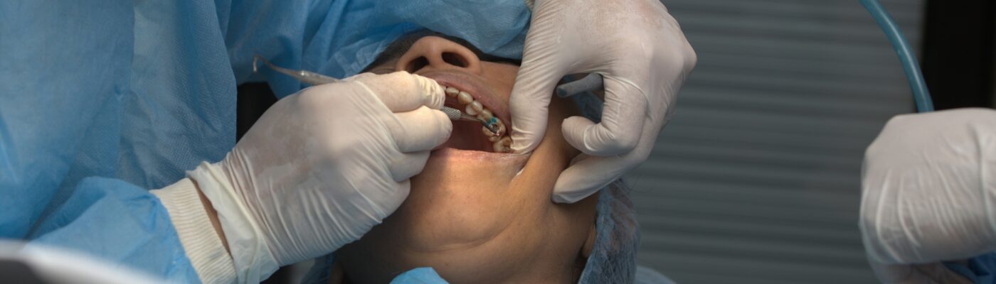 6 Tips For A Smooth Recovery After Implant Surgery