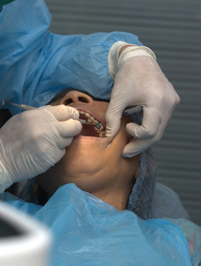 6 tips for a smooth recovery after implant surgery