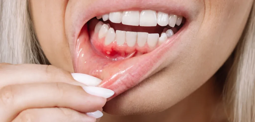 4 signs a tooth infection may be spreading