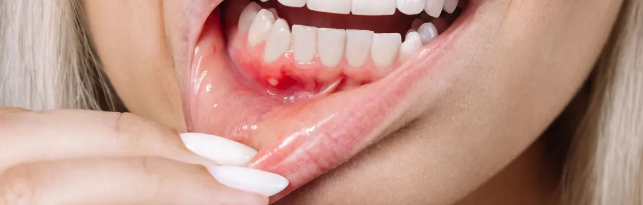 4 Signs A Tooth Infection May Be Spreading