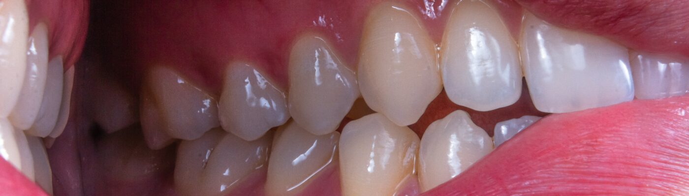 Why Preventive Dentistry Is Key To Preserving Natural Teeth