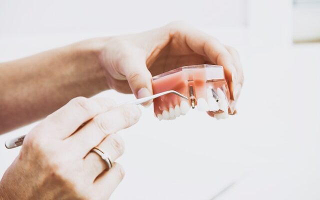 How Periodontal Therapy Improves Implant Outcomes