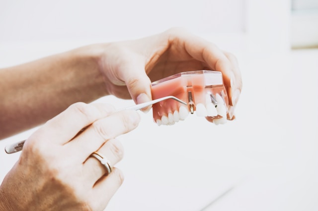how periodontal therapy improves implant outcomes