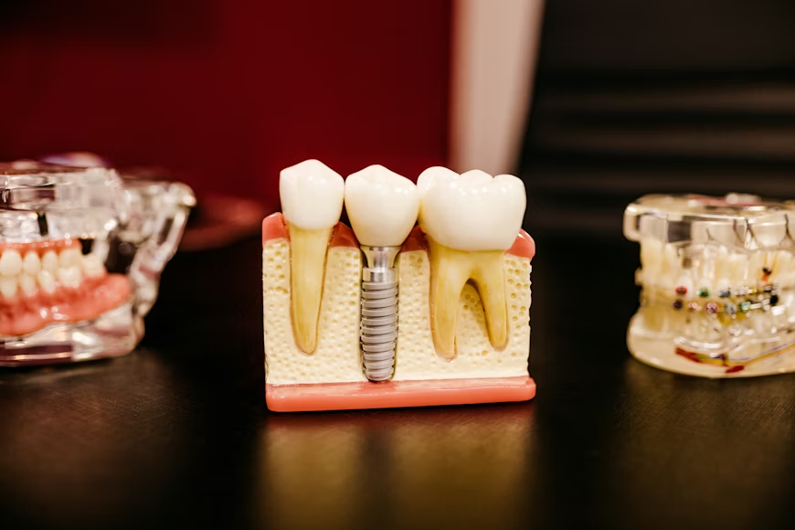Word image 1505 1 Live Sv how general dentistry bridges preventive and cosmetic dentistry together